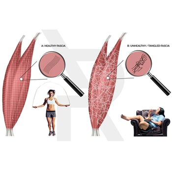 how to maintain healthy fascia