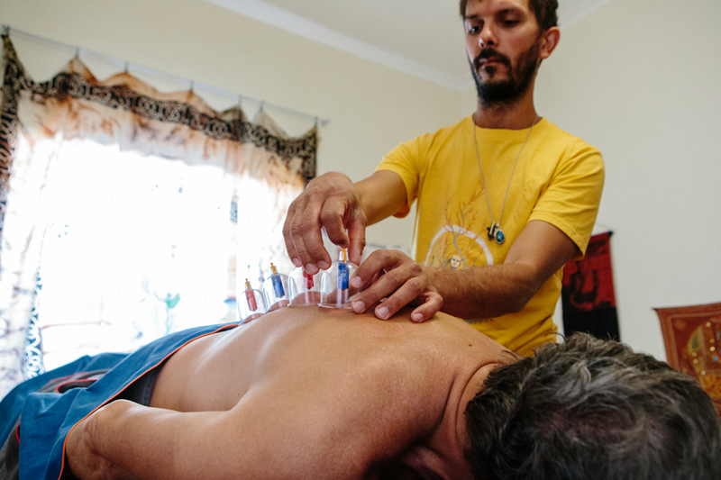 Cupping Session Remedial Massage