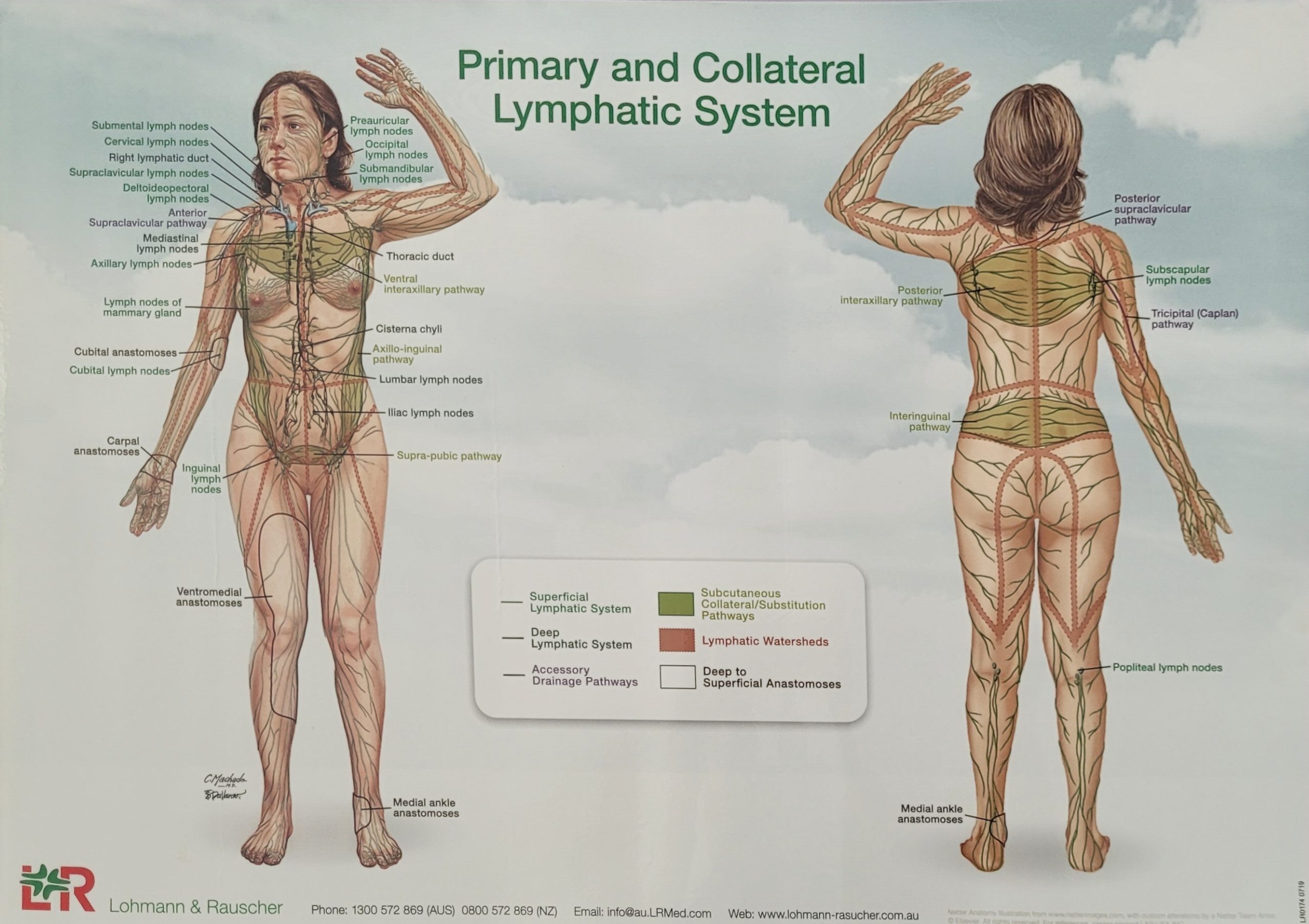 Understanding Lymphoedema and the Role of CDT