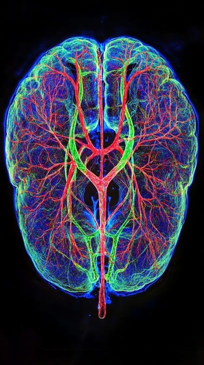 Brain's vein and arteries visualisation