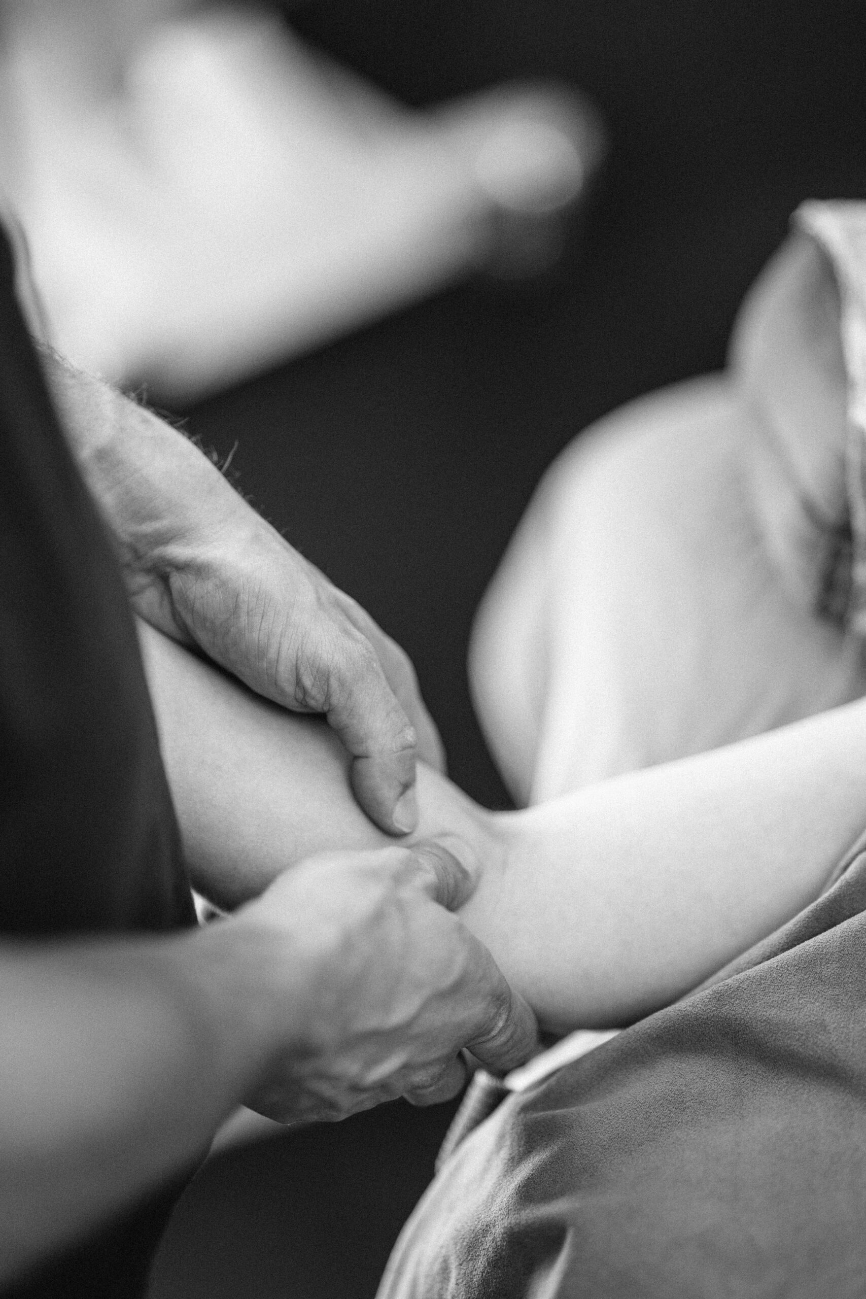 MLD applied on Arm post Cosmetic Surgery