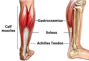 A picture of the calf injury